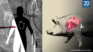 El exitoso trasplante un corazón de un cerdo en un cuerpo humano sin rechazo llevado a cabo por la Facultad de Medicina de la Universidad de Maryland, en Estados Unidos, ha consolidado un hito "histórico" para la Medicina y posibilita un horizonte esperanzador para posibles tratamientos a personas que se quedan sin alternativa cuando las posibilidades de éxito se acaban al no disponer de órganos humanos.