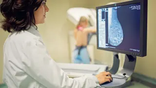 La inflamación crónica podría contribuir al desarrollo del cáncer de mama.